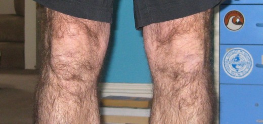 Image of knees