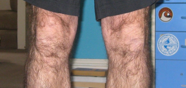 Image of knees